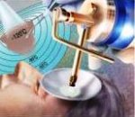 krioterapija-u-dermatologiji